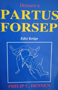 Partus forsep