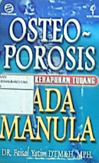 Osteoporosis (penyakit kerapuhan tulang) pada tulang