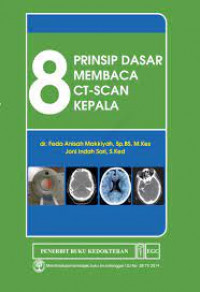 8 prinsip dasar membaca CT-scan kepala