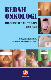 Bedah onkologi diagnosis dan terapi edisi ke 2