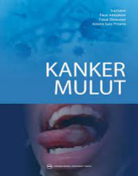 Kanker mulut