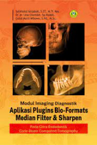 Modul imaging diagnostik aplikasi plugins bio-formats median filter & shatpen pada citra endodontik cone beam computed tomography