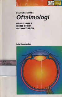 Lecture notes : oftalmologi